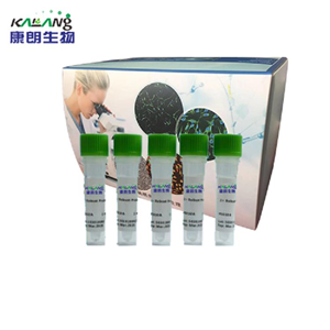 结核分枝杆菌PCR试剂盒