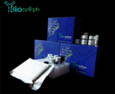 人硫氧还蛋白结合蛋白2(TBP2)ELISA试剂盒 YB74316Hu,TBP2