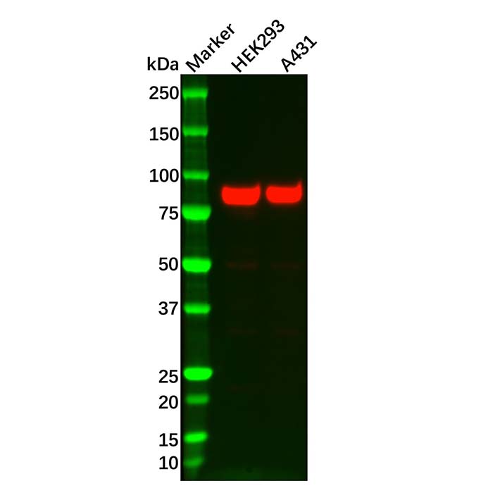 Recombinant Glycogen synthase 1/GYS1 Antibody