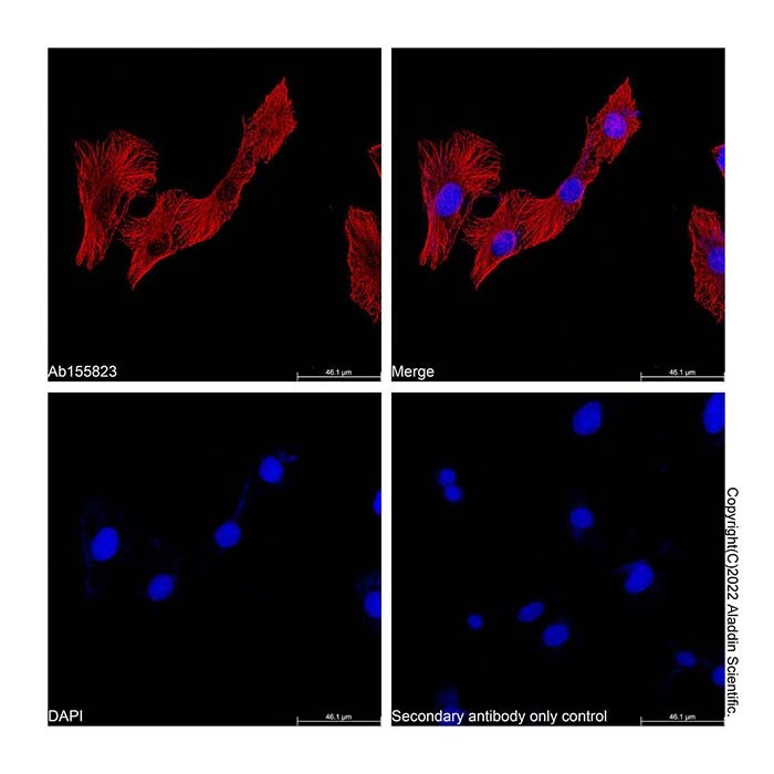 NeutrAvidin Protein (TRITC)