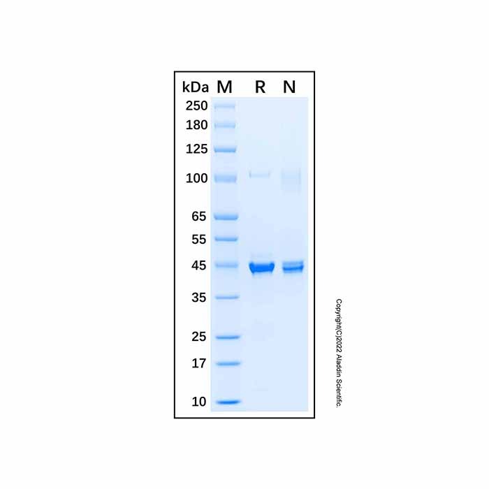 Recombinant Human DHPS/DHS Protein