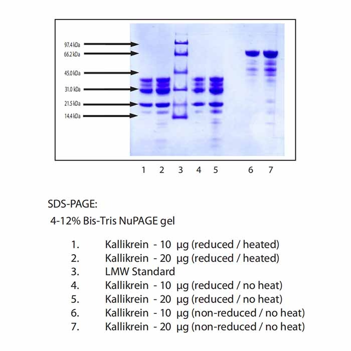 激肽释放酶,人血浆