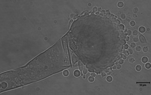 Graphical abstract: Real-time PCR for detection of the Aspergillus genus