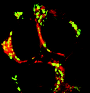 Graphical abstract: Lower sensitivity of FHC fetal colon epithelial cells to photodynamic therapy compared to HT-29 colon adenocarcinoma cells despite higher intracellular accumulation of hypericin