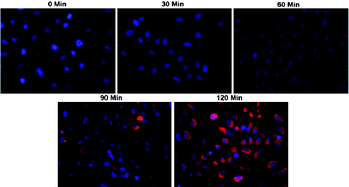 Graphical abstract: Monodisperse mesoporous cobalt ferrite nanoparticles: synthesis and application in targeted delivery of antitumor drugs