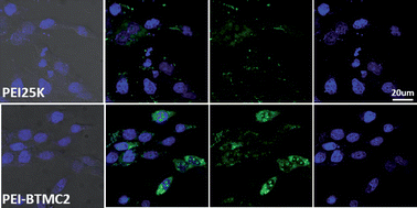 Graphical abstract: Extraordinarily enhanced gene transfection and cellular uptake by aromatic hydrophobicization to PEI25K