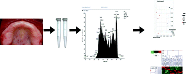 Graphical abstract: Exploring salivary proteomes in edentulous patients with type 2 diabetes