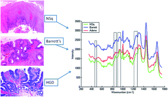 Graphical abstract: Vibrational spectroscopy for cancer diagnostics