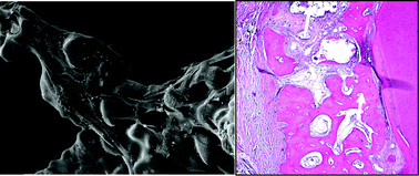 Graphical abstract: Porous nagelschmidtite bioceramic scaffolds with improved in vitro and in vivo cementogenesis for periodontal tissue engineering