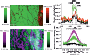 Graphical abstract: Oncologic photodynamic diagnosis and therapy: confocal Raman/fluorescence imaging of metal phthalocyanines in human breast cancer tissue in vitro