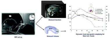 Graphical abstract: The glycemic response to fibre rich foods and their relationship with gastric emptying and motor functions: an MRI study