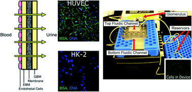 Graphical abstract: A novel microfluidic device to model the human proximal tubule and glomerulus
