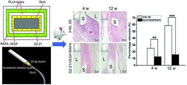 Graphical abstract: Design, preparation and performance of a novel drug-eluting stent with multiple layer coatings