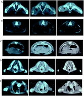 Graphical abstract: Effects of casein non-phosphopeptide on the development of rat muscle analyzed using computed tomography scanning technology