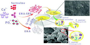 Graphical abstract: Repurposing of antidepression drug sertraline for antimicrobial activity against Staphylococcus aureus: a potential approach for the treatment of osteomyelitis