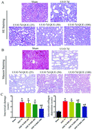Graphical abstract: Quercetin inhibits kidney fibrosis and the epithelial to mesenchymal transition of the renal tubular system involving suppression of the Sonic Hedgehog signaling pathway