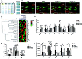 Graphical abstract: Alterations in serum protein glycopatterns related to small cell lung cancer, adenocarcinoma and squamous carcinoma of the lung