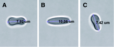 Graphical abstract: Quantifying the influences of radiation therapy on deformability of human red blood cells by dual-beam optical tweezers