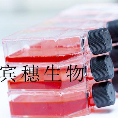 KGN;人卵巢颗粒扩增性好细胞|配套专用培养基