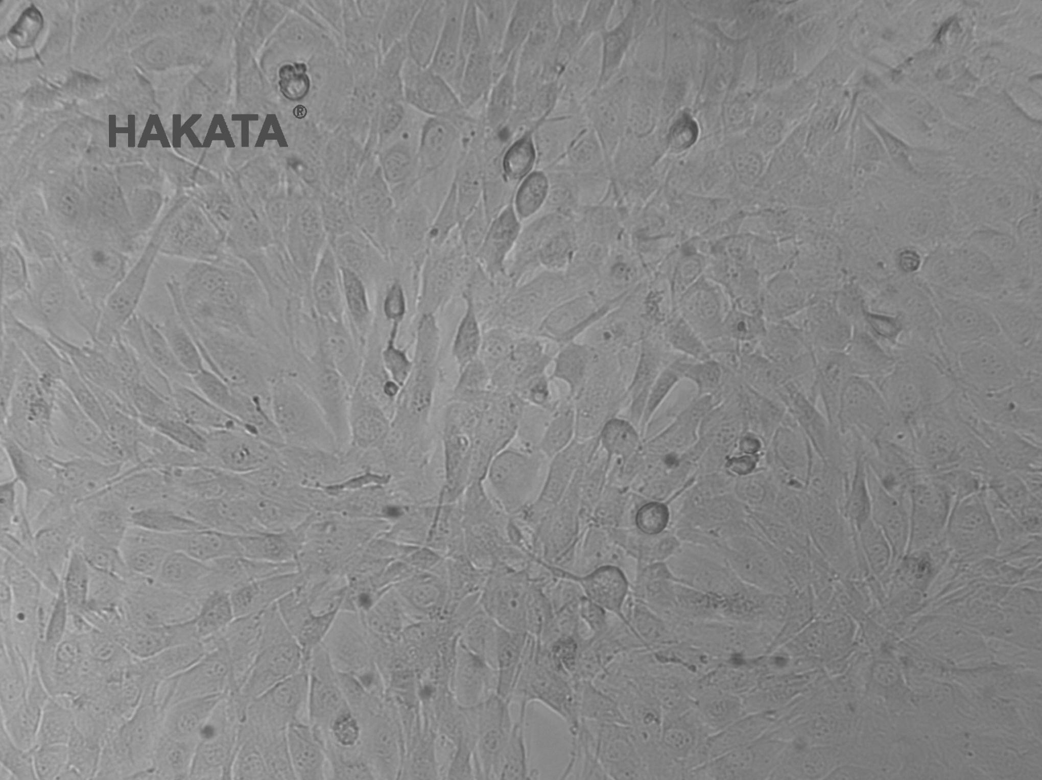 CT26.WT,小鼠结肠癌细胞,CT26.WT小鼠结肠癌细胞CT26.WT