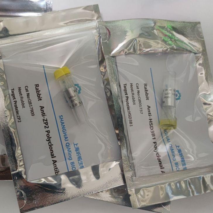 兔抗人钙卫蛋白(CALPRO)抗体