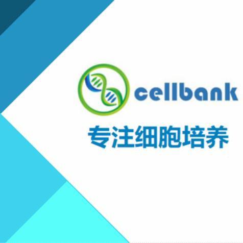 EJ/EJ细胞/EJ膀胱癌细胞；EJ