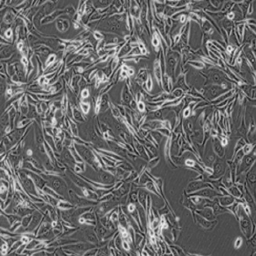 A172(胶质母细胞瘤细胞)