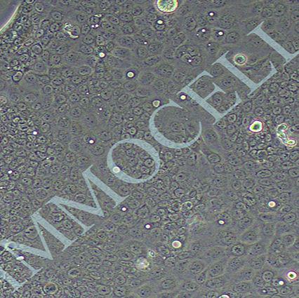 Capan-2人胰腺癌细胞丨Capan-2细胞株丨STR鉴定