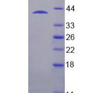硫代硫酸盐转硫酶(TST)重组蛋白(多属种)