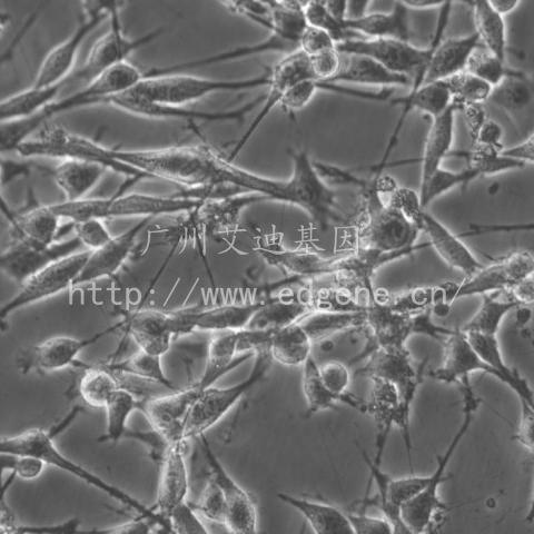 MC38/小鼠结肠癌细胞