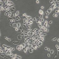 人血管瘤内皮细胞HemECs