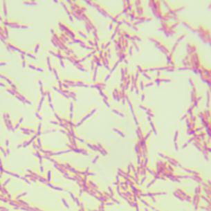 匍匐放射毛霉（雅致放射毛霉）