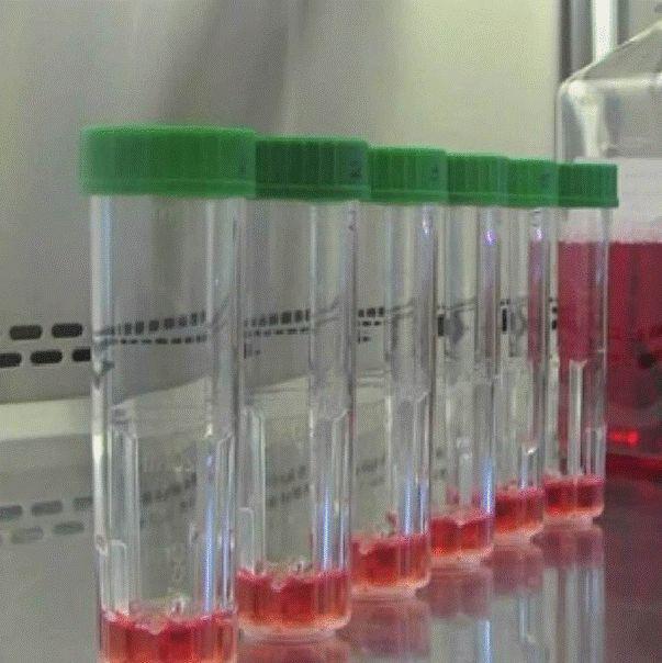 人骨髓、脂肪、脐带、胎盘羊膜、牙髓等间充质干细胞