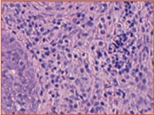 体外侵袭模型（INV检测）和系统化乳腺癌骨转移模型（METS检测）