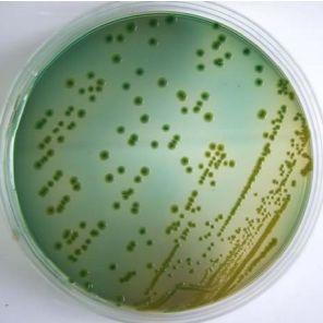 Vibrio tapetis 蛤属绦虫弧菌