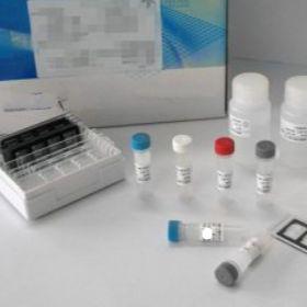 大鼠醛固酮(ALD)ELISA Kit