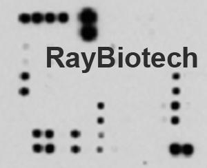 人类表皮生长因子受体磷酸化抗体芯片