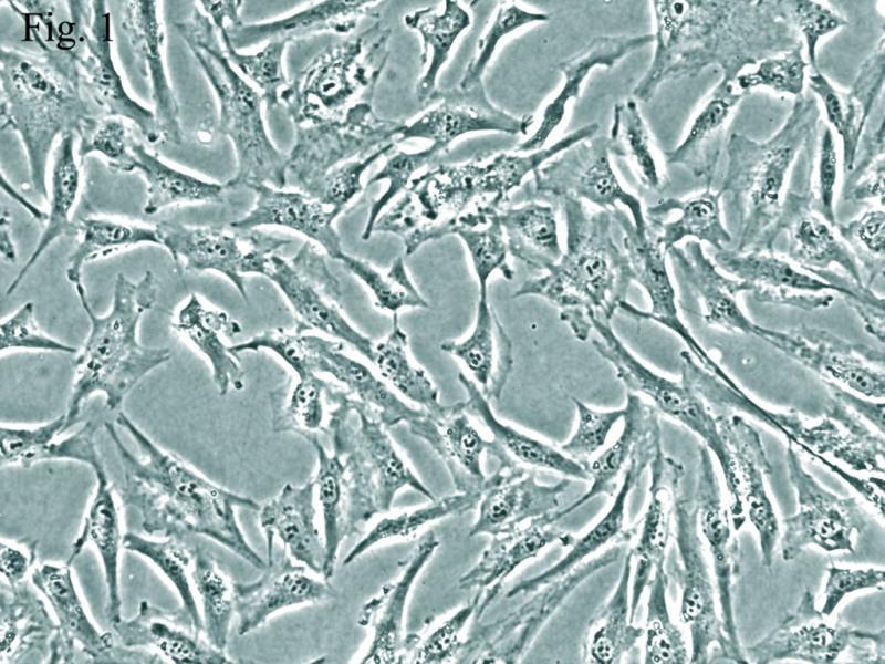 人前脂肪细胞-内脏