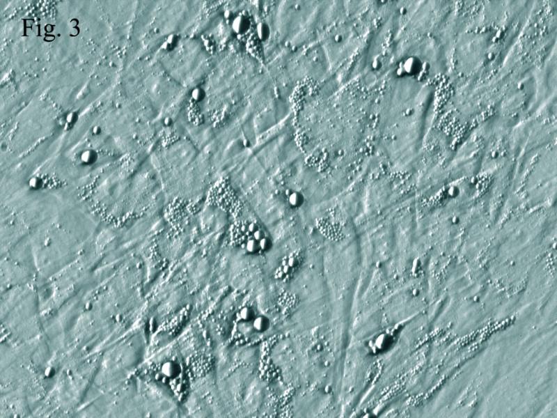 人前脂肪细胞-皮下