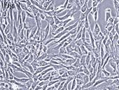 人间充质干细胞-肝脏 