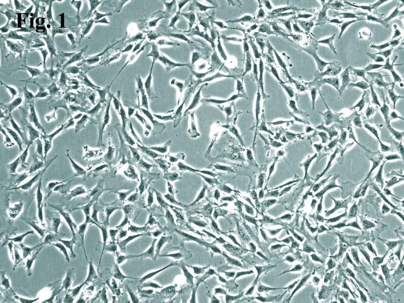 人脉络丛成纤维细胞