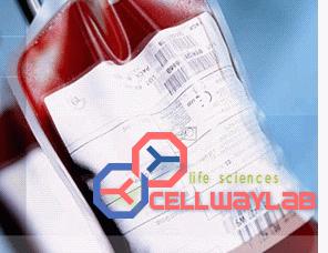 小鼠抗人血清白蛋白