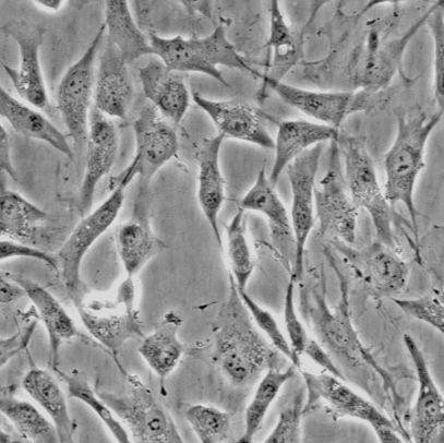 WM115 人黑色素瘤细胞