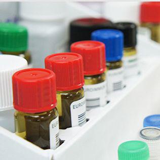 抗EB病毒衣壳抗原IgM检测试剂盒