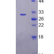 cAMP应答元件结合蛋白5(CREB5)重组蛋白(多属种)