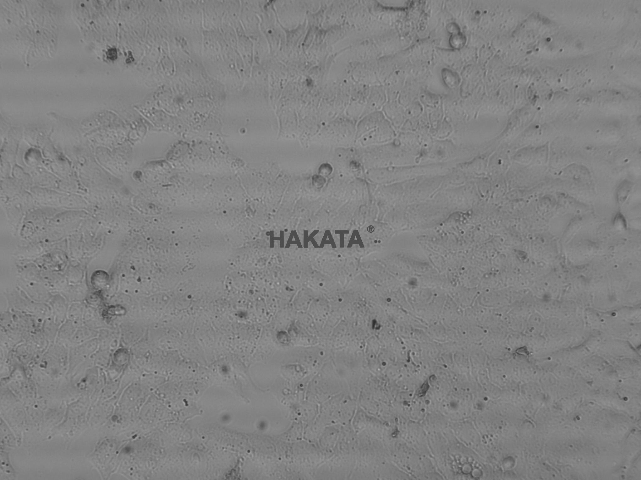 4T1+luc细胞,小鼠乳腺癌细胞荧光素酶标记,4T1+luc细胞小鼠乳腺癌细胞荧光素酶标记