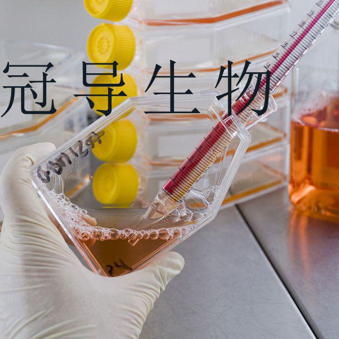 HIBEC：人肝内胆管上皮反复传代细胞|完全培养基
