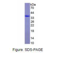 膜联蛋白A5(ANXA5)真核蛋白