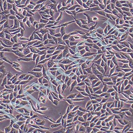 RKO 人结肠腺癌细胞丨rko细胞系