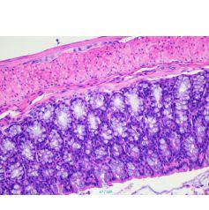 小鼠结肠炎模型构建